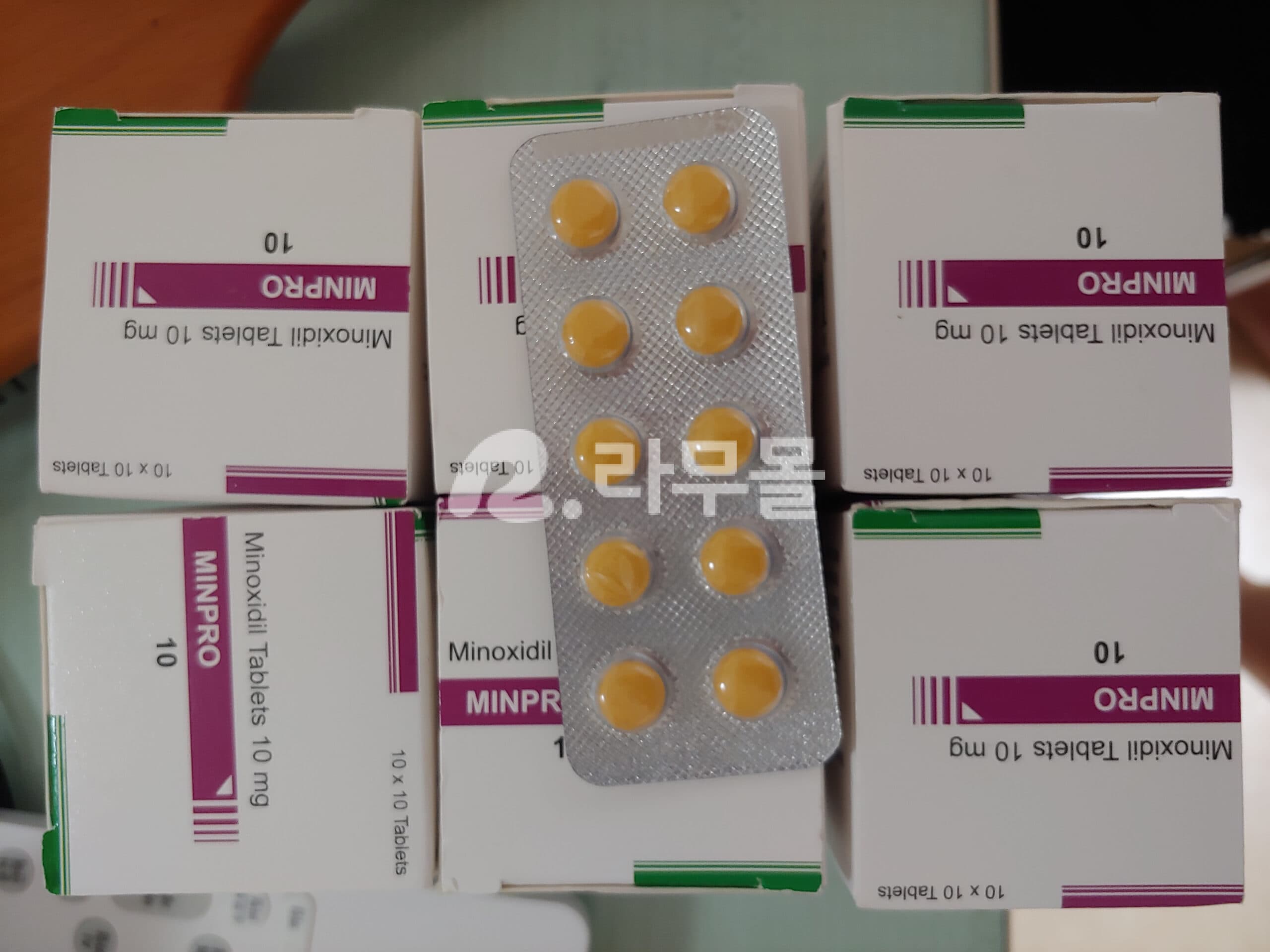 미녹시딜 민프로 10mg 직구 후기