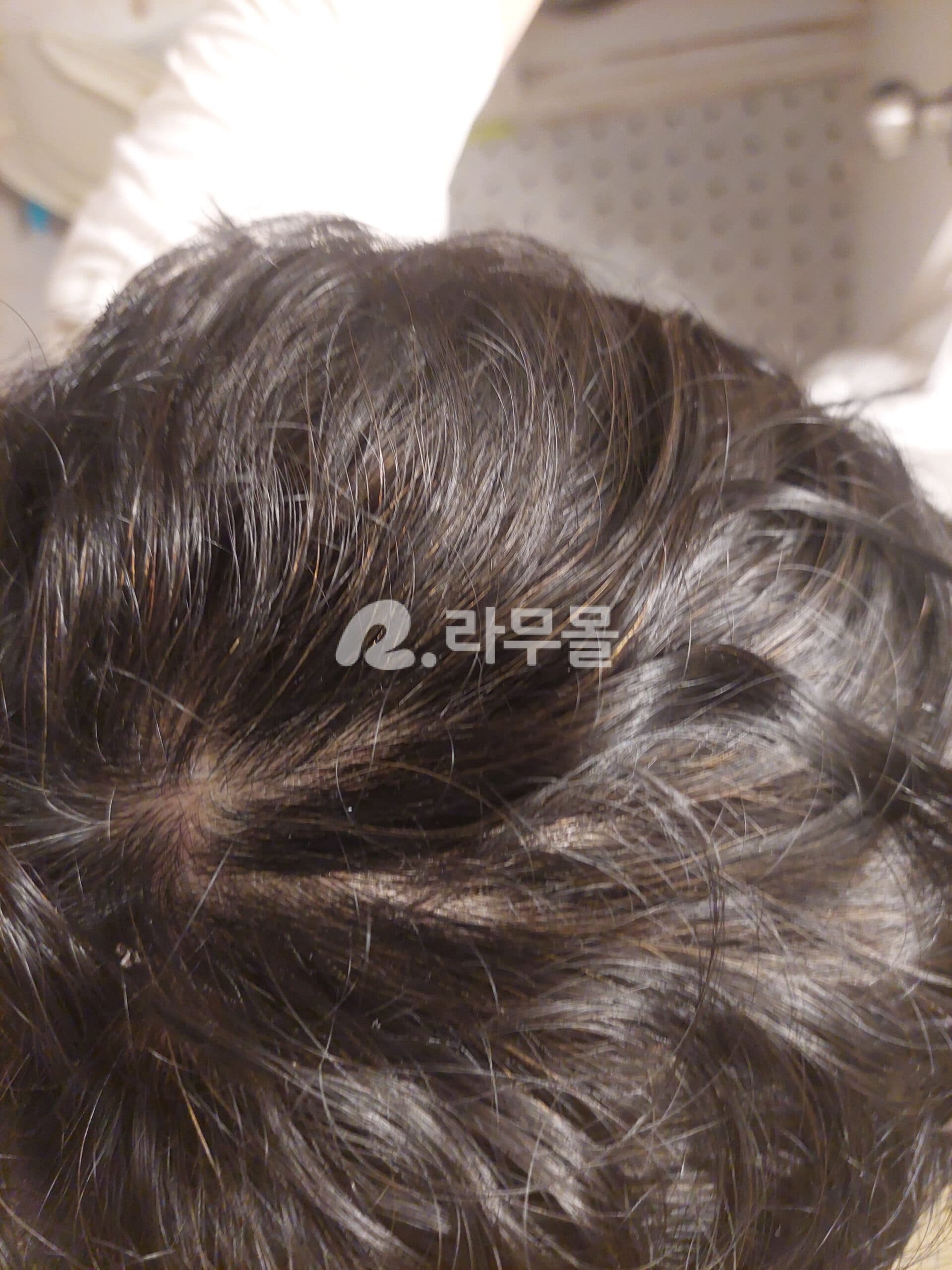 두타힐 (아보다트 제네릭 0.5mg) 직구 후기