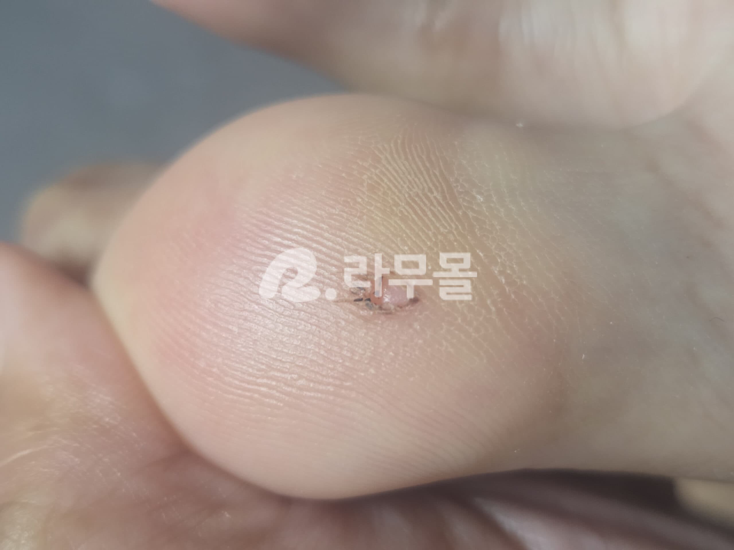 데멜란 크림 Demelan Cream 직구 후기